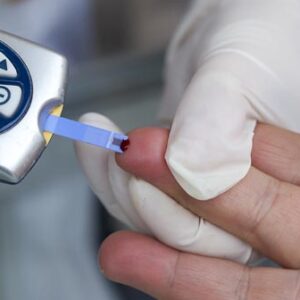 Toma de Muestras (Point Of Care Testing) POCT