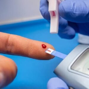 Toma de Muestras (Point Of Care Testing) POCT